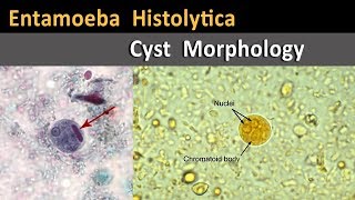 Entamoeba Histolytica Cyst Morphology [upl. by Leirol]