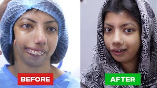 The Most Stunning Plastic Surgery Transformation [upl. by Hallimaj]