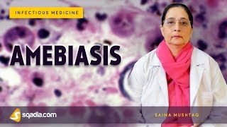 Amebiasis  Entamoeba Histolytica Disease  Infectious Medicine Lectures  VLearning [upl. by Ches]