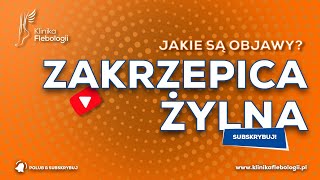 ZAKRZEPICA ŻYLNA  jakie są jej objawy [upl. by Amliw]