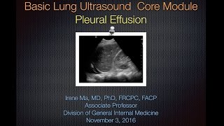 Pleural Effusion [upl. by Kaia624]