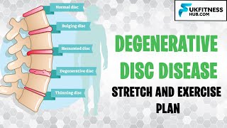 DDD  Degenerative Disc Disease Stretch And Exercise Plan [upl. by Nhepets499]