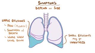 Pleural Effusion causes symptoms diagnosis treatment pathology [upl. by Ramas405]