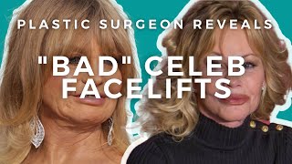 What went wrong with Goldie Hawn and Melanie Griffiths Facelifts [upl. by Nnayelsel]