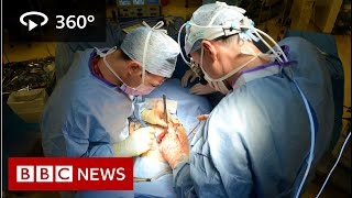 In 360 Oesophageal cancer operation filmed  BBC News [upl. by Inohtna]