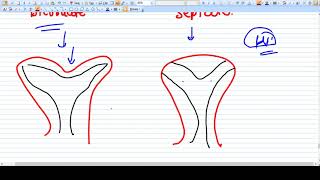 Uterine Rupture Explained by a Lawyer [upl. by Matthew]