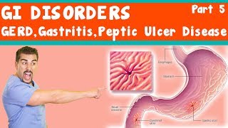 Ulcerative Colitis versus Crohns Disease Animation [upl. by Harbard]