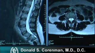 How to Read a MRI of the Normal Lumbar Spine  LowerBack  Vail Spine Specialist [upl. by Yordan350]