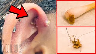 CLEAN Your Piercings Or THIS Can Happen…REMOVAL [upl. by Glaab]