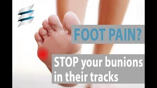 Get rid of foot pain  Tailors Bunion [upl. by Rehtse]