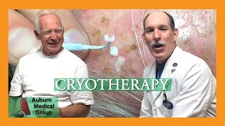 Actinic Keratosis Frozen with Cryotherapy  Auburn Medical Group [upl. by Undis]