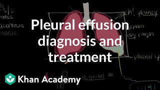 Pleural effusion diagnosis and treatment  Respiratory system diseases  NCLEXRN  Khan Academy [upl. by Carlene]