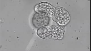 Entamoeba histolytica trophozoites [upl. by Hersh]