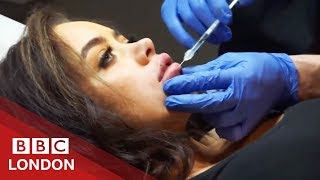 Plastic surgery gone wrong My lip was about to fall off  BBC London [upl. by Tegdig]