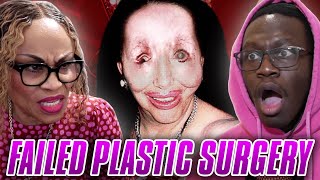 MOM REACTS TO PLASTIC SURGERY DISASTERS [upl. by Iiette]