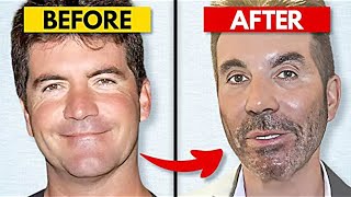 20 Celebrity Plastic Surgery Disasters [upl. by Alonzo840]