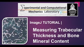 ImageJ Tutorial  Measurements of trabecular thickness bone fraction area using threshold colors [upl. by Chaiken367]