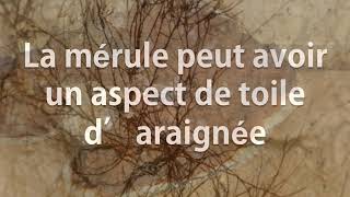 Comment reconnaître la Mérule PAMI votre expert du traitement anti termites [upl. by Carlee]