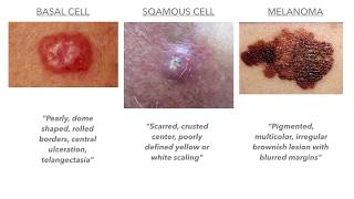 Dermatology on USMLECOMLEX [upl. by Lindblad]