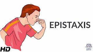 Epistaxis Causes SIgns and Symptoms Diagnosis and Treatment [upl. by Plate]