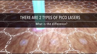 Why Are There Different Types of Pico Laser  Dr Kenneth Thean [upl. by Trebuh]