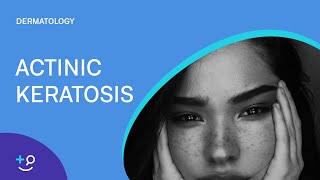 Actinic Keratosis Dermatology [upl. by Arrahs]