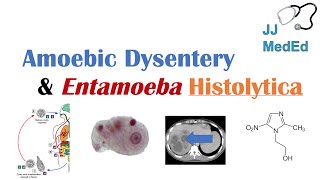 Amebiasis Amoebic Dysentery  Entamoeba histolytica Pathogenesis Signs amp Symptoms Treatment [upl. by Seys219]