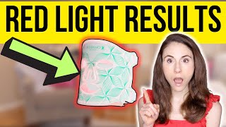 DO LED LIGHT MASKS REALLY WORK  Dermatologist reviews Omnilux [upl. by Alracal]