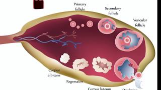 Ovarian Cysts [upl. by Eilsel733]