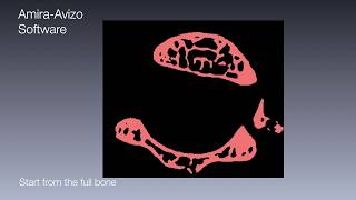 Cortical and trabecular bone segmentation with Amira Software [upl. by Aihselat660]